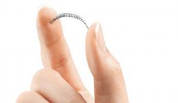 L'implant Essure.