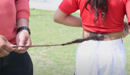 Une queue de cheveux pousse dans le dos de cet adolescent
