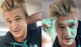 Il trouve un remède imparable pour lutter contre la calvitie